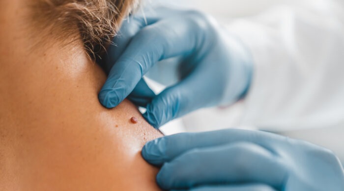 Skin examination close-up