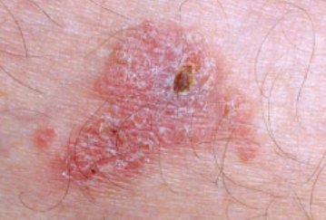 Skin examination close-up