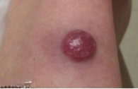 Skin examination close-up